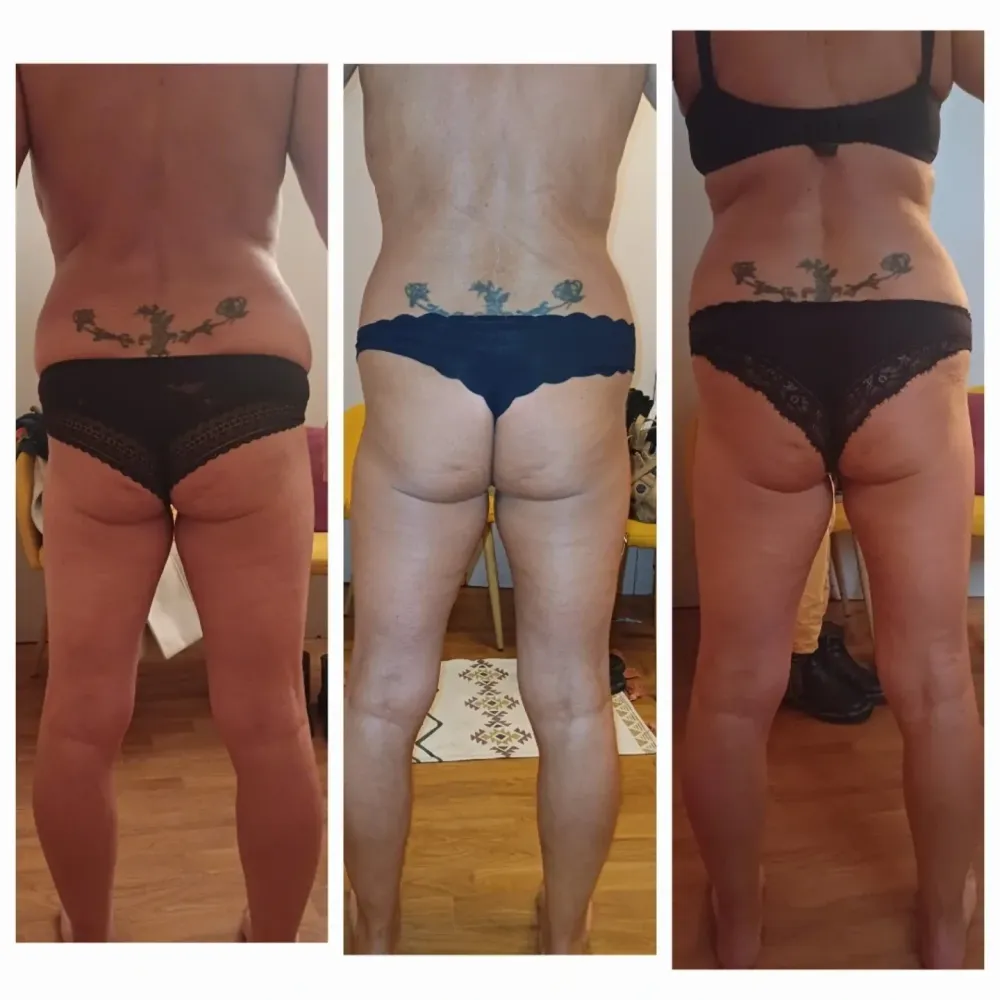 madérothérapie cuisses fesses